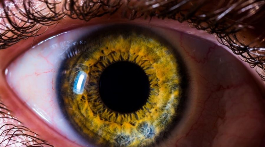 antibióticos en conjuntivitis viral